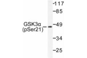 Image no. 1 for anti-Glycogen Synthase Kinase 3 alpha (GSK3a) (pSer21) antibody (ABIN318029) (GSK3 alpha antibody  (pSer21))
