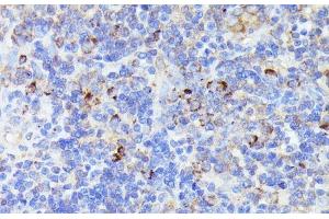 Immunohistochemistry of paraffin-embedded Rat lymph node using CCDC6 Polyclonal Antibody at dilution of 1:100 (40x lens).