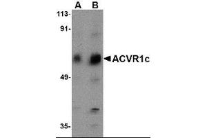 Western blot analysis of ACVR1C in human placenta tissue lysate with ACVR1C antibody at (A) 1 and (B) 2 ug/ml.