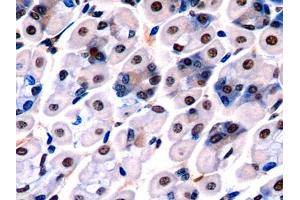 Immunohistochemistry (IHC) image for anti-Acidic (Leucine-Rich) Nuclear phosphoprotein 32 Family, Member A (ANP32A) (AA 2-247) antibody (ABIN1858013)