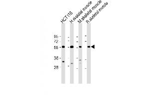 All lanes : Anti-TRIM72 Antibody (C-term) at 1:2000 dilution Lane 1: HC whole cell lysate Lane 2: human skeletal muscle lysate Lane 3: mouse skeletal muscle lysate Lane 4: rat skeletal muscle lysate Lysates/proteins at 20 μg per lane. (TRIM72 antibody  (C-Term))