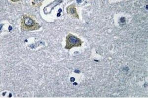 Image no. 2 for anti-Carbonic Anhydrase VB, Mitochondrial (CA5B) antibody (ABIN317824)