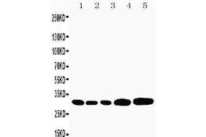 Anti-Caspase-3(P10) antibody,  Western blotting Lane 1: Rat Liver Tissue Lysate Lane 2: Rat Thymus Tissue Lysate Lane 3: Rat Spleen Tissue Lysate Lane 4: HEPA Cell Lysate Lane 5: NEURO Cell Lysate (Caspase 3 antibody  (C-Term))