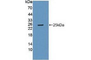 Detection of Recombinant LAMa4, Mouse using Polyclonal Antibody to Laminin Alpha 4 (LAMa4) (LAMa4 antibody  (AA 745-940))