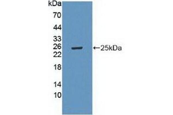LAMa4 Antikörper  (AA 745-940)