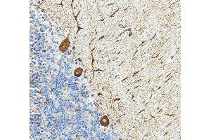 anti-P21 Protein (Cdc42/Rac)-Activated Kinase 7 (PAK7) (AA 26-55), (N-Term) antibody