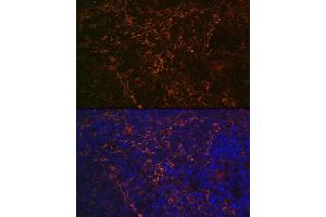 Immunofluorescence analysis of rat spleen using CD23 Rabbit mAb (ABIN7267160) at dilution of 1:100 (40x lens). (FCER2 antibody)