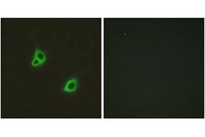 Immunofluorescence analysis of HuvEc cells, using GPR126 Antibody.