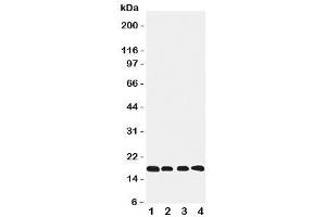 Western blot testing of Cyclophilin B antibody and Lane 1:  rat ovary (PPIB antibody  (C-Term))