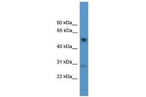 WB Suggested Anti-Ppp2r2c Antibody Titration: 0. (PPP2R2C antibody  (N-Term))