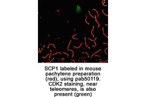 Image no. 1 for anti-Synaptonemal Complex Protein 1 (SYCP1) (C-Term) antibody (ABIN363428) (SYCP1 antibody  (C-Term))