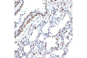 Immunohistochemistry of paraffin-embedded rat lung using Histone H2A Rabbit mAb (ABIN7267703) at dilution of 1:100 (40x lens). (HIST1H2AE antibody)
