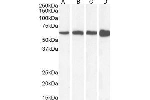 Western Blotting (WB) image for anti-Catalase (CAT) (Internal Region) antibody (ABIN185651)