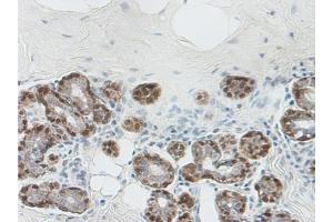 Immunohistochemistry (Paraffin-embedded Sections) (IHC (p)) image for anti-serpin Peptidase Inhibitor, Clade B (Ovalbumin), Member 5 (SERPINB5) antibody (ABIN487960)