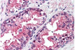 Human Prostate (formalin-fixed, paraffin-embedded) stained with VCP antibody ABIN239859 at 5 ug/ml followed by biotinylated anti-mouse IgG secondary antibody ABIN481714, alkaline phosphatase-streptavidin and chromogen. (VCP antibody)