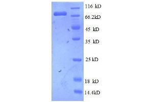 SDS-PAGE (SDS) image for Epidermal Growth Factor Receptor (EGFR) (AA 26-645), (partial) protein (His tag) (ABIN1046976)