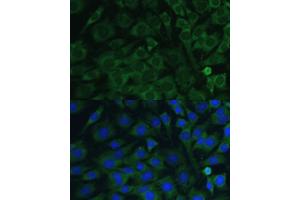 Immunofluorescence analysis of C6 cells using Oncostatin M antibody (ABIN6128404, ABIN6145072, ABIN6145073 and ABIN6221768) at dilution of 1:100. (Oncostatin M antibody  (AA 26-252))