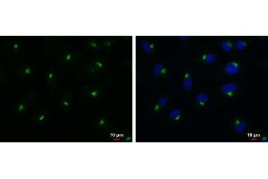 ICC/IF Image RAB6A antibody detects RAB6A protein at Golgi apparatus by immunofluorescent analysis. (RAB6A antibody)