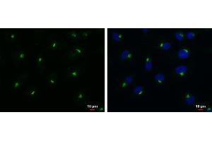 ICC/IF Image RAB6A antibody detects RAB6A protein at Golgi apparatus by immunofluorescent analysis. (RAB6A antibody)