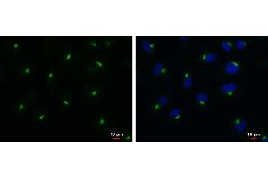 ICC/IF Image RAB6A antibody detects RAB6A protein at Golgi apparatus by immunofluorescent analysis.