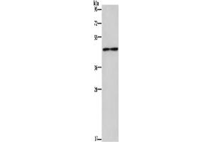 Western Blotting (WB) image for anti-Interleukin 5 Receptor, alpha (IL5RA) antibody (ABIN2826983) (IL5RA antibody)