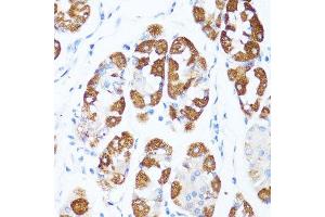 Immunohistochemistry (Paraffin-embedded Sections) (IHC (p)) image for anti-Cytochrome C, Somatic (CYCS) (AA 1-105) antibody (ABIN6139304)