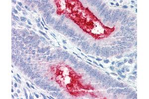 Anti-ENPP3 antibody IHC of human uterus. (ENPP3 antibody  (Internal Region))