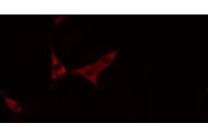 ABIN6269377 staining NIH-3T3 cells by IF/ICC. (TRKB antibody  (C-Term))
