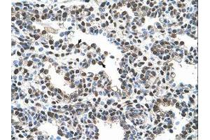 Image no. 1 for anti-Advanced Glycosylation End Product-Specific Receptor (AGER) (AA 251-300) antibody (ABIN6736617) (RAGE antibody  (AA 251-300))