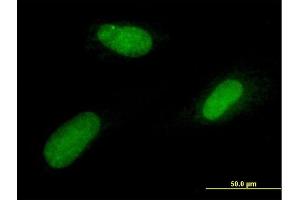 Immunofluorescence of purified MaxPab antibody to TTRAP on Hs 181. (TDP2 antibody  (AA 1-362))