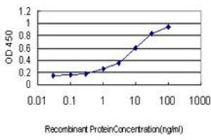 Detection limit for recombinant GST tagged ETV6 is approximately 0. (ETV6 antibody  (AA 1-452))