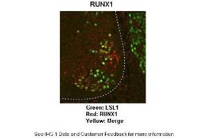 Immunohistochemistry (IHC) image for anti-Runt-Related Transcription Factor 1 (RUNX1) (Middle Region) antibody (ABIN2792598)