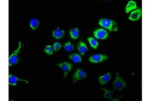 Immunofluorescence staining of A549 cells with ABIN7127407 at 1:51, counter-stained with DAPI. (Recombinant CD63 antibody)