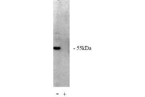 Image no. 1 for anti-Protein Phosphatase 2, Regulatory Subunit A, beta (PPP2R1B) antibody (ABIN264940) (PPP2R1B antibody)