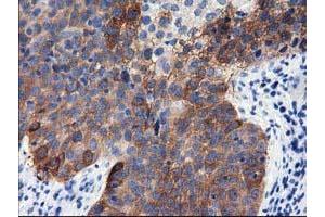 Immunohistochemical staining of paraffin-embedded Human pancreas tissue using anti-ALDH1L1 mouse monoclonal antibody. (ALDH1L1 antibody)