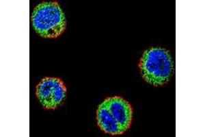 Confocal immunofluorescent analysis of MDA-MB435 cells using NFKBIL1  Antibody  (C-term), followed by Alexa Fluor 488-conjugated goat anti-rabbit lgG (green). (NFKBIL1 antibody  (C-Term))