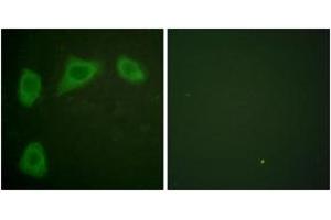 Immunofluorescence analysis of HuvEc cells, using Caveolin-1 Antibody. (Caveolin-1 antibody  (AA 129-178))
