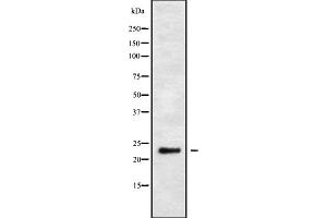 Western blot analysis of MRP-L48 using HuvEc whole cell lysates (MRPL48 antibody  (Internal Region))