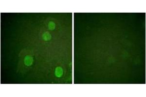 Immunofluorescence analysis of HuvEc cells, using Histone H4 (Phospho-Ser47) Antibody. (Histone H4 antibody  (pSer47))