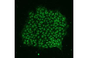 Figure 1: (SOX2 antibody)