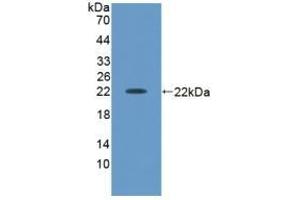 Detection of Recombinant ACVA, Human using Polyclonal Antibody to Activin A (ACVA) (ACVA antibody  (AA 44-178))