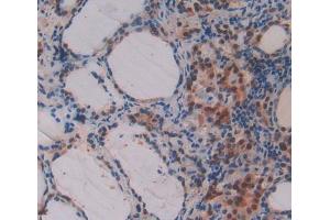 Figure. (PFDN1 antibody  (AA 1-122))