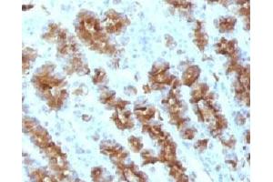 Formalin-fixed, paraffin-embedded rat stomach stained with TNF alpha antibody. (TNF alpha antibody)
