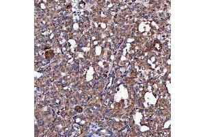 IHC analysis of SCO1 using anti-SCO1 antibody (ABIN7600609). (SCO1 antibody  (AA 21-301))