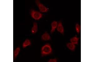 ABIN6275705 staining LOVO by IF/ICC. (ZP1 antibody  (Internal Region))