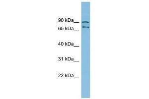 MTRR antibody used at 1 ug/ml to detect target protein. (MTRR antibody  (N-Term))