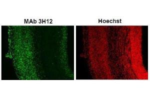 Immunofluorescence (IF) image for anti-Small Ubiquitin Related Modifier 2/3 (SUMO2/3) (full length) antibody (ABIN2452139) (SUMO2/3 antibody  (full length))
