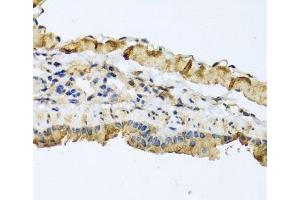 Immunohistochemistry of paraffin-embedded Mouse lung using ATP2C1 Polyclonal Antibody at dilution of 1:100 (40x lens).