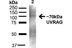 Western blot analysis of Rat Liver showing detection of ~70kDa UVRAG protein using Rabbit Anti-UVRAG Polyclonal Antibody .