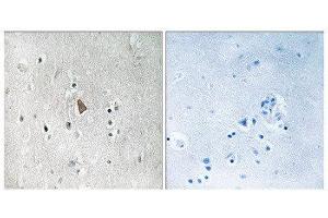 Immunohistochemistry (IHC) image for anti-Insulin-Like Growth Factor 1 Receptor (IGF1R) (pTyr1346) antibody (ABIN1847558) (IGF1R antibody  (pTyr1346))